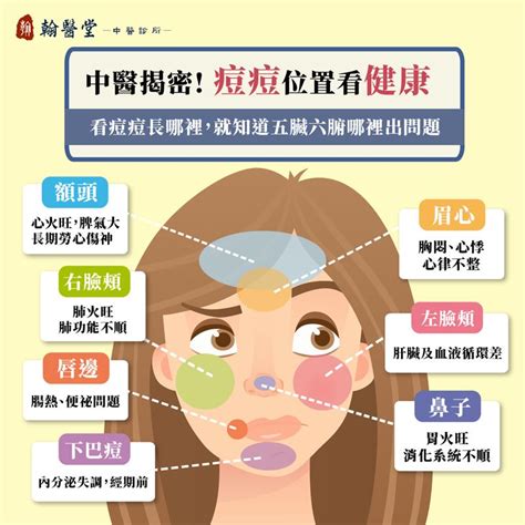 左眉長痘痘|眉毛、人中長痘痘的原因？10個「青春痘位置」對應你。